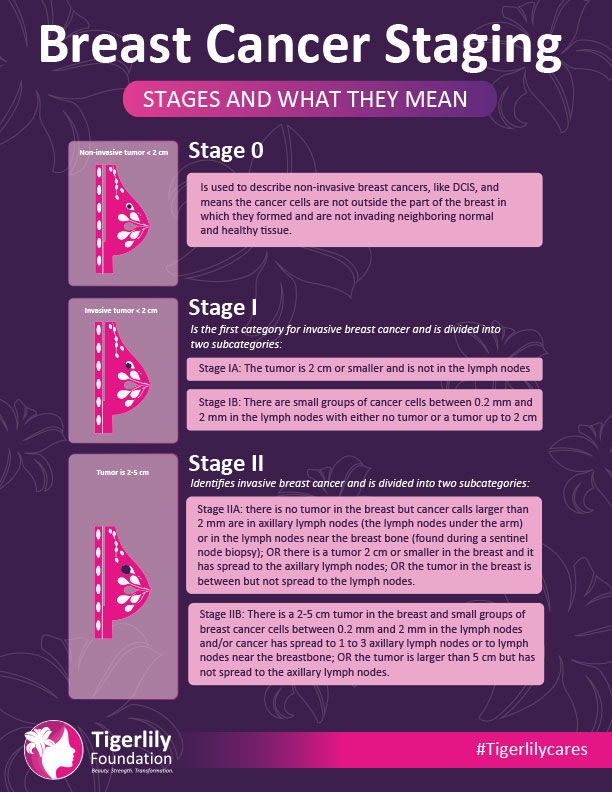 Breast Cancer Staging (PDF)